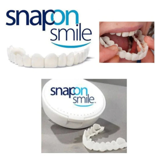 Sonríe con Confianza al Instante – Carillas Snap-On para una Sonrisa Perfecta